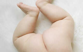 Лучшие средства от опрелостей у новорожденных: список детских кремов и мазей для грудничков